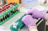Estudio chino ofrece evidencia de mejor tratamiento de apoplejía