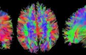 Las imágenes del cerebro pueden revelar lo que está pensando una persona