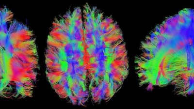 Las imágenes del cerebro pueden revelar lo que está pensando una persona