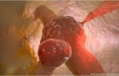 Científicos descubren las células malignas responsables de la recaída en el cáncer de colon