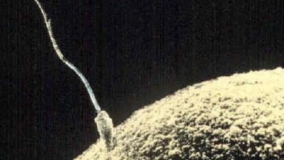 Un estudio revela que los espermatozoides en los hombres se redujeron más de la mitad en las últimas décadas