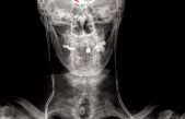 Las señales cerebrales podrían ser la clave para tratar el dolor crónico
