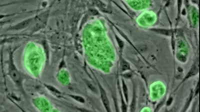 Gran avance en la medicina regenerativa: células madre para reparar tejidos dañados