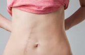 Melanina sintética: la nueva terapia para regenerar la piel y borrar cicatrices