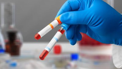 Un análisis de sangre para calcular el envejecimiento de cada órgano y prevenir enfermedades
