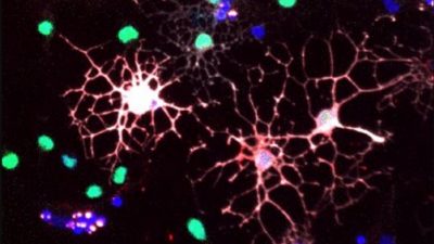 Las células reguladoras del sistema inmune aumentan con la edad, pero reducen su contribución a la regeneración de mielina