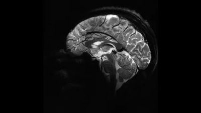 Así se ve el cerebro humano gracias a la máquina de resonancia más potente del mundo