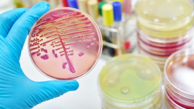 Un estudio muestra una estrategia de inactivación de bacterias multirresistentes